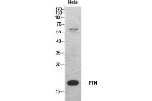 Western Blot analysis of hela cells using PTN Polyclonal Antibody. (Pleiotrophin Antikörper  (Internal Region))