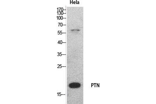 Pleiotrophin Antikörper  (Internal Region)