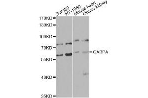Western blot analysis of extracts of various cell lines, using GABPA antibody. (GABPA Antikörper)