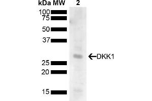 Western blot analysis of Human 293T showing detection of 28. (DKK1 Antikörper  (AA 120-220) (PerCP))