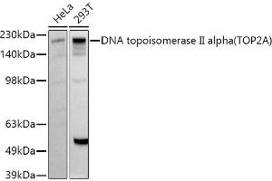 Western blot analysis of extracts of various cell lines, using DNA topoisomerase II alpha (TOP2A) antibody (ABIN7270853) at 1:1000 dilution. (Topoisomerase II alpha Antikörper  (AA 1050-1150))