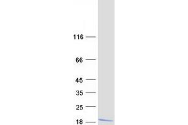 DNAJC19 Protein (Myc-DYKDDDDK Tag)