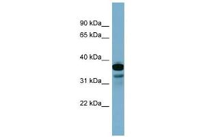 FLJ25791 antibody used at 1 ug/ml to detect target protein. (FLJ25791 (Middle Region) Antikörper)