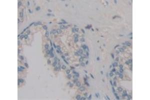 Used in DAB staining on fromalin fixed paraffin- embedded Kidney tissue (POTEG Antikörper  (AA 177-330))
