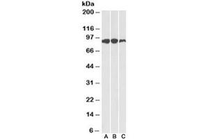Western blot of human (A), mouse (B) and rat (C) adipose lysates with Aconitase 2 antibody at 0. (ACO2 Antikörper)