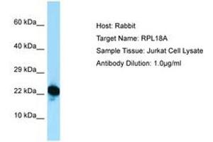 Image no. 1 for anti-Ribosomal Protein L18a (RPL18A) (C-Term) antibody (ABIN6749890) (RPL18A Antikörper  (C-Term))