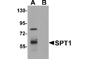 Western blot analysis of SPT1 in human lung tissue lysate with SPT1 antibody at 1 µg/mL in (A) the absence and (B) the presence of blocking peptide. (SPTLC1 Antikörper  (C-Term))