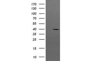Image no. 2 for anti-Mitogen-Activated Protein Kinase Kinase 3 (MAP2K3) antibody (ABIN1499420) (MAP2K3 Antikörper)