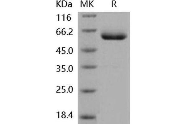 Coxsackie Adenovirus Receptor Protein (His tag,Fc Tag)