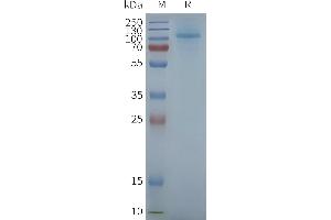 Human R3-Nanodisc, Flag Tag on SDS-PAGE (TAS1R3 Protein)