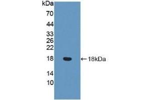 Detection of Recombinant vWF, Human using Polyclonal Antibody to Von Willebrand Factor (vWF) (VWF Antikörper  (AA 1498-1665))