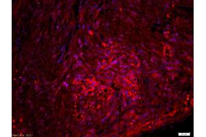 Immunofluorescence (Paraffin-embedded Sections) (IF (p)) image for anti-Catenin, beta (CATNB) (pSer33), (pSer37) antibody (ABIN683893)