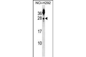 Western blot analysis in NCI-H292 cell line lysates (35ug/lane). (Tetraspanin 2 Antikörper  (N-Term))