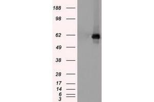 Western Blotting (WB) image for anti-Checkpoint Kinase 2 (CHEK2) antibody (ABIN1497495) (CHEK2 Antikörper)