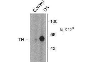 Image no. 2 for anti-Tyrosine Hydroxylase (TH) (pSer31) antibody (ABIN227933) (Tyrosine Hydroxylase Antikörper  (pSer31))