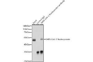 Immunoprecipitation analysis of 300 μg extracts of 293T cells using 3 μg SARS-CoV-2 Nucleoprotein antibody (ABIN7269053). (Nucleoprotein Antikörper)