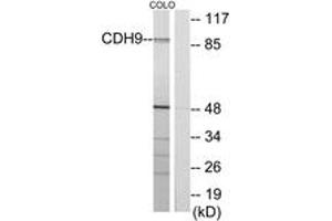 Western blot analysis of extracts from COLO cells, using CDH9 Antibody. (Cadherin 9 Antikörper  (AA 201-250))