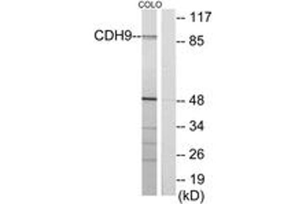 Cadherin 9 Antikörper  (AA 201-250)