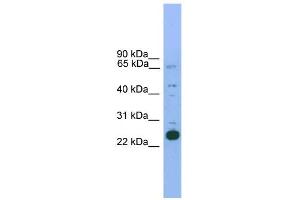 WB Suggested Anti-Nkx2-6 Antibody Titration: 0. (NKX2-6 Antikörper  (N-Term))