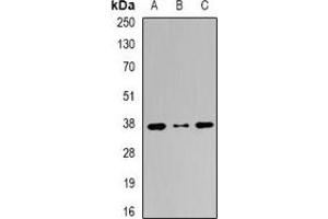 Western blot analysis of PICOT expression in MCF7 (A), A431 (B), Hela (C) whole cell lysates. (GLRX3 Antikörper)