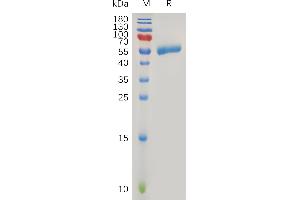Human CC Protein, hFc Tag on SDS-PAGE under reducing condition. (CLEC4C Protein (Fc Tag))