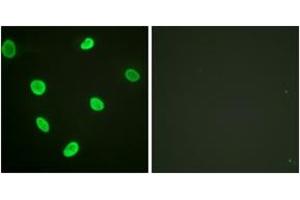 Immunofluorescence (IF) image for anti-Histone H2B (acLys12) antibody (ABIN2890727) (Histone H2B Antikörper  (acLys12))