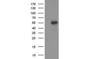 Western Blotting (WB) image for anti-Tumor Protein P53 (TP53) antibody (ABIN1499975) (p53 Antikörper)