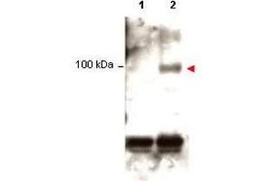 Western blot using  Protein A purified anti-Stat1 pY701 antibody shows detection of phosphorylated Stat1 (indicated by arrowhead at ~91 kDa) in K562 cells after 30 min treatment with 1Ku of hIFN-? (STAT1 Antikörper  (pTyr701))