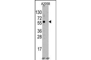 Western blot analysis of anti-ST13 Antibody pre-incubated with and without blocking peptide (BP6247a) in A2058 cell line lysate. (HSC70 Interacting Protein HIP Antikörper  (AA 50-80))