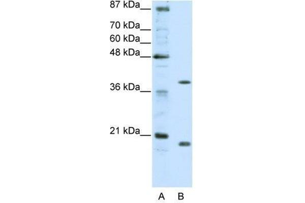 ZNF322A Antikörper  (C-Term)