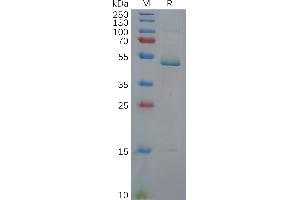 IL17C Protein (AA 19-197) (Fc Tag)