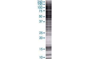 ALDH3A2 transfected lysate. (ALDH3A2 293T Cell Transient Overexpression Lysate(Denatured))