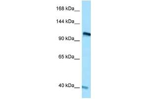 WB Suggested Anti-RET Antibody Titration: 1. (Ret Proto-Oncogene Antikörper  (C-Term))