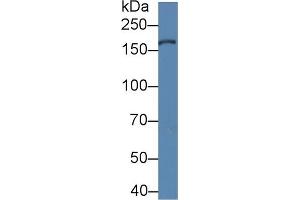 Detection of XDH in Porcine Liver lysate using Polyclonal Antibody to Xanthine Dehydrogenase (XDH) (XDH Antikörper  (AA 1-300))