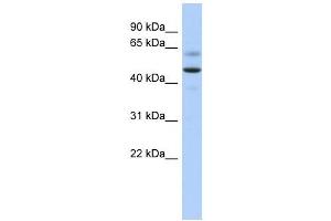 ARSA antibody used at 1 ug/ml to detect target protein. (Arylsulfatase A Antikörper  (Middle Region))