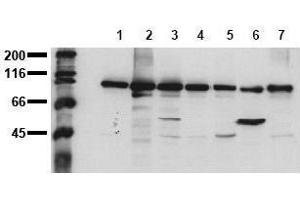 Western Blotting (WB) image for anti-Catenin (Cadherin-Associated Protein), beta 1, 88kDa (CTNNB1) (C-Term) antibody (ABIN126749) (CTNNB1 Antikörper  (C-Term))