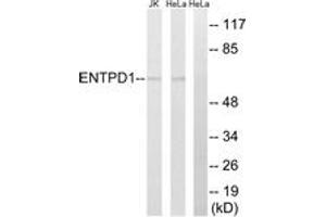 Western blot analysis of extracts from HeLa/Jurkat cells, using ENTPD1 Antibody. (CD39 Antikörper  (AA 351-400))