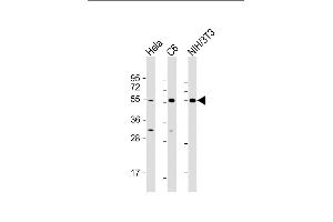 All lanes : Anti-PTEN Antibody (N-term) at 1:500-1:2000 dilution Lane 1: Hela whole cell lysate Lane 2: C6 whole cell lysate Lane 3: NIH/3T3 whole cell lysate Lysates/proteins at 20 μg per lane. (PTEN Antikörper  (N-Term))