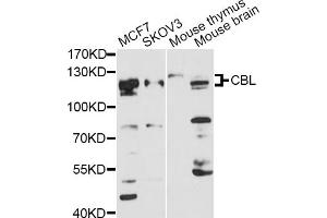 Western blot analysis of extracts of various cell lines, using CBL antibody. (CBL Antikörper)