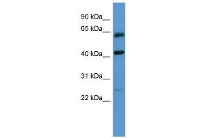 WB Suggested Anti-GPRC5B Antibody Titration: 0. (GPRC5B Antikörper  (N-Term))