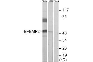 Western blot analysis of extracts from K562 cells and 3T3 cells, using EFEMP2 antibody. (FBLN4 Antikörper  (Internal Region))