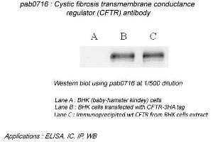 Image no. 2 for anti-Cystic Fibrosis Transmembrane Conductance Regulator (ATP-Binding Cassette Sub-Family C, Member 7) (CFTR) (N-Term) antibody (ABIN559719) (CFTR Antikörper  (N-Term))