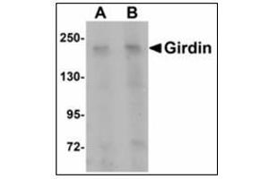 Western blot analysis of Girdin in rat brain tissue lysate with Girdin antibody at (A) 1 and (B) 2 µg/ml. (Girdin Antikörper  (C-Term))