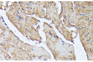 Immunohistochemistry of paraffin-embedded Mouse heart using HAL Polyclonal Antibody at dilution of 1:100 (40x lens). (HAL Antikörper)