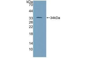 Detection of Recombinant TP53, Mouse using Polyclonal Antibody to Tumor Protein p53 (P53) (p53 Antikörper  (AA 134-387))