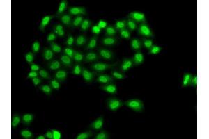 Immunofluorescence analysis of A549 cell using PHF11 antibody. (PHF11 Antikörper)