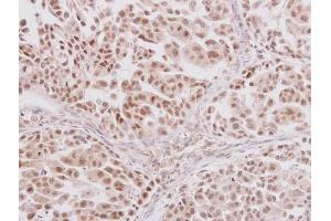 Immunohistochemistry (IHC) image for anti-GLI Family Zinc Finger 3 (GLI3) antibody (ABIN2855813)