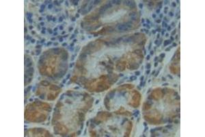 IHC-P analysis of Kidney tissue, with DAB staining. (NUAK1 Antikörper  (AA 421-658))