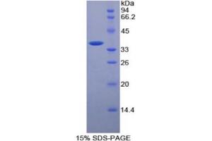 SDS-PAGE analysis of Mouse MCAM Protein. (MCAM Protein)