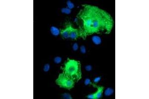 Anti-SCHIP1 mouse monoclonal antibody (ABIN2455645) immunofluorescent staining of COS7 cells transiently transfected by pCMV6-ENTRY SCHIP1 (RC206269). (SCHIP1 Antikörper)